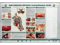 310_Заболевания_верхних_дыхательных_путей