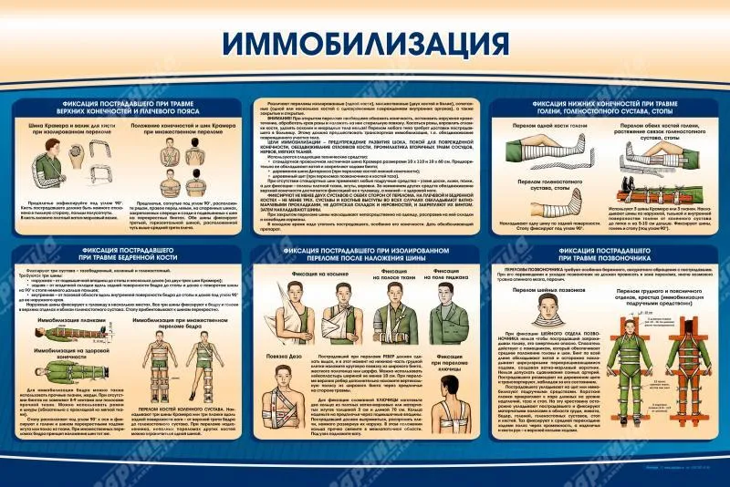 Стенд "Иммобилизация" — купить в МЕДСЕТ