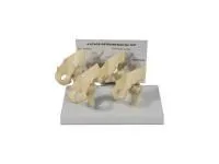 310_ZM2092_Модель патологий тазобедренного сустава