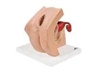 Обучающая гинекологическая модель для медицинского просвещения пациентов