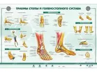 310_Стенд_Травмы_стопы_голеностопного_сустава