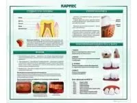 310_МУ0255_Стенд_Кариес