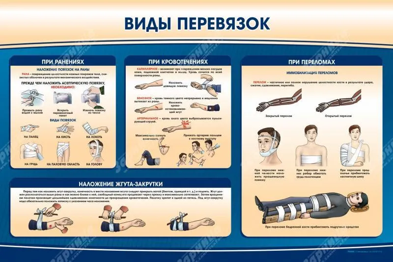 Оказание первой помощи: Стенд "Виды перевязок" — купить в МЕДСЕТ