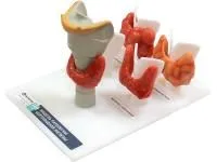 310_Модель_щитовидной_железы