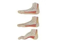 310_SMD045_Набор моделей стопы (нормальная, плоская, вогнутая)