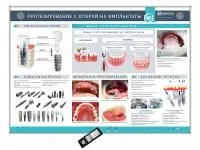 310_МУ0211_Стенд_Протезирование_с_опорой_на_имплантаты