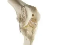 310_1019622 Колено, стандартное, левое, ORTHOBone 1