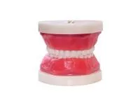 310_МУ0206_Денто-модель_ЧВН-24_1