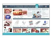 310_МУ0212_Стенд_Удаление_поддесневых_зубных_отложений