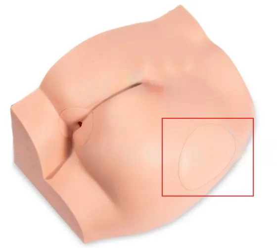 Ягодицы: область пункций