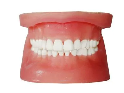 Денто-модель верхней и нижней челюстей для удаления ретенированных зубов