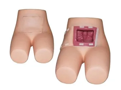 Тренажер ВОЛОДЕФ-1 для отработки навыков проведения клизмы