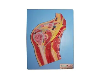 Модель плечевого сустава в разрезе (на подставке)