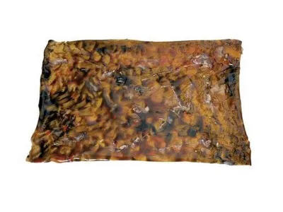 Ожоги 3-ей степени