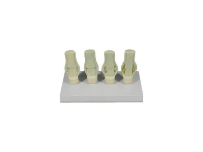 Модель патологий коленного сустава в разрезе