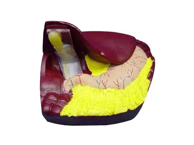 Лапароскопическая модель для проведения холецистэктомии