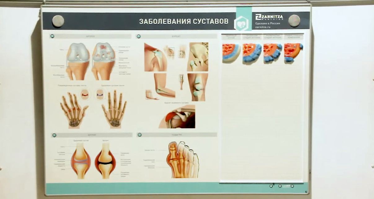 Интерактивный электрифицированный стенд "Заболевания суставов" с натурными образцами — купить в МЕДСЕТ