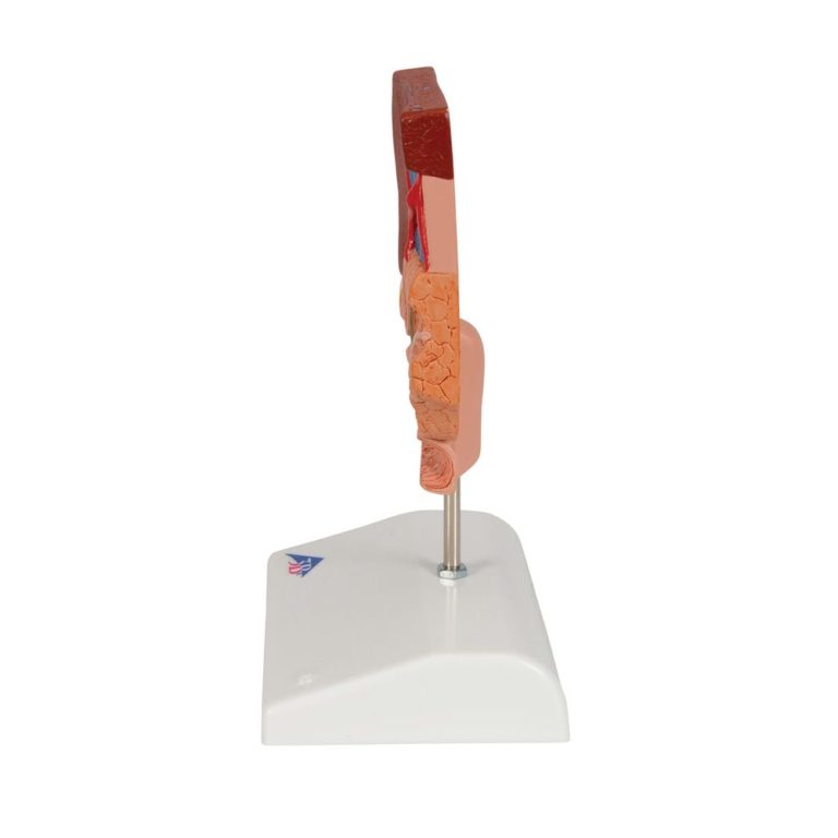 Модель желчного камня — купить в МЕДСЕТ