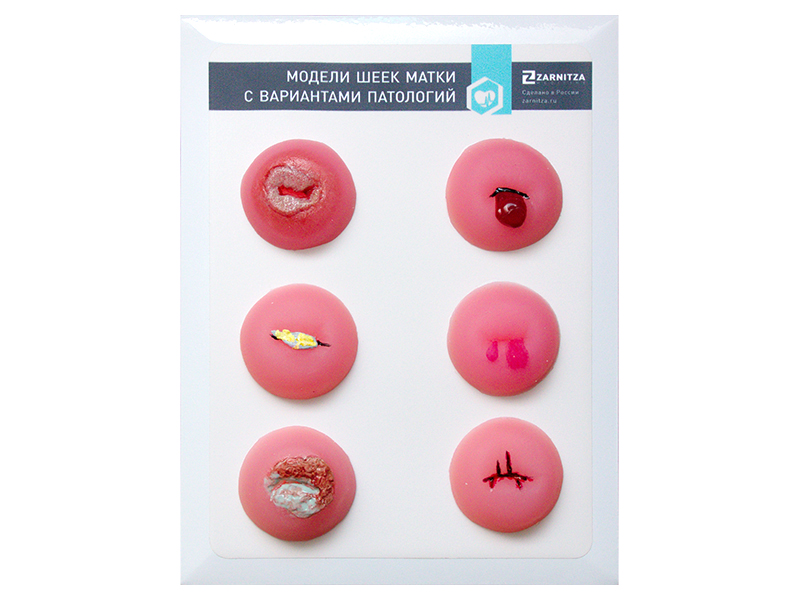Модели шеек матки с вариантами патологий — купить в МЕДСЕТ