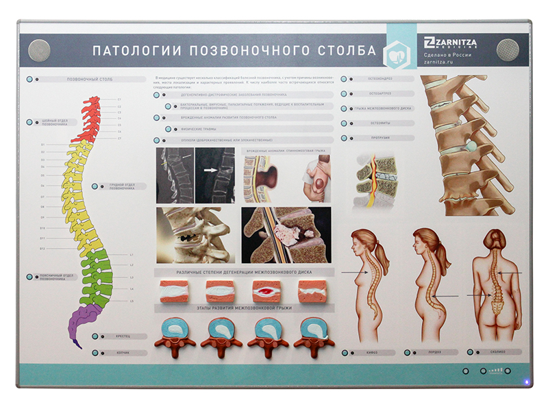 Интерактивный электрифицированный стенд "Патологии позвоночного столба" с натурными образцами — купить в МЕДСЕТ
