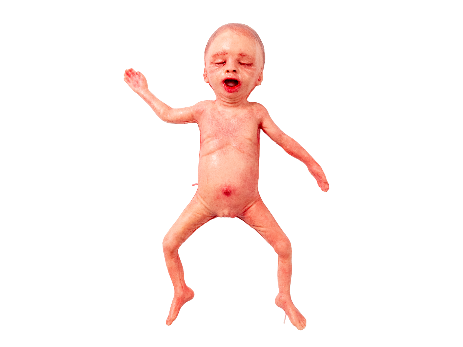 Манекен недоношенного новорожденного — купить в МЕДСЕТ