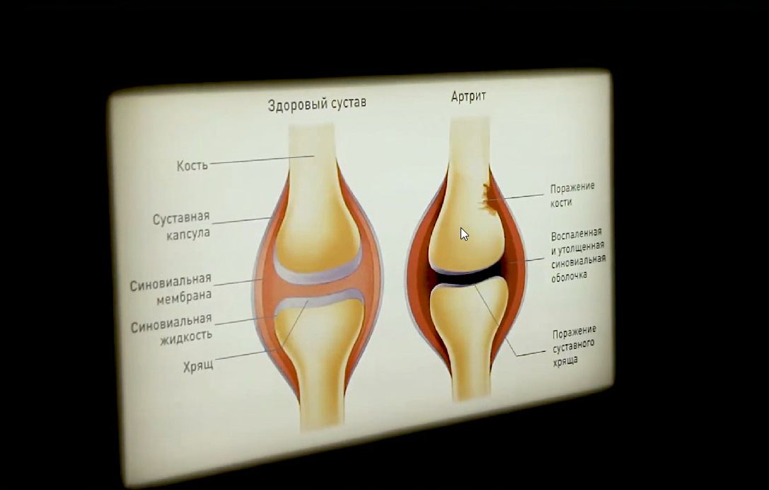 Интерактивный электрифицированный стенд "Заболевания суставов" с натурными образцами — купить в МЕДСЕТ