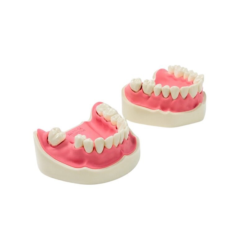 Модель верхней и нижней челюстей c имитацией поздней стадии пародонтита PD-PM — купить в МЕДСЕТ