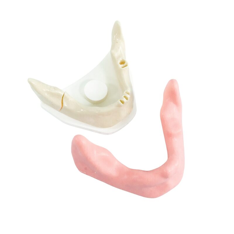 Хирургические модели с переломами — купить в МЕДСЕТ