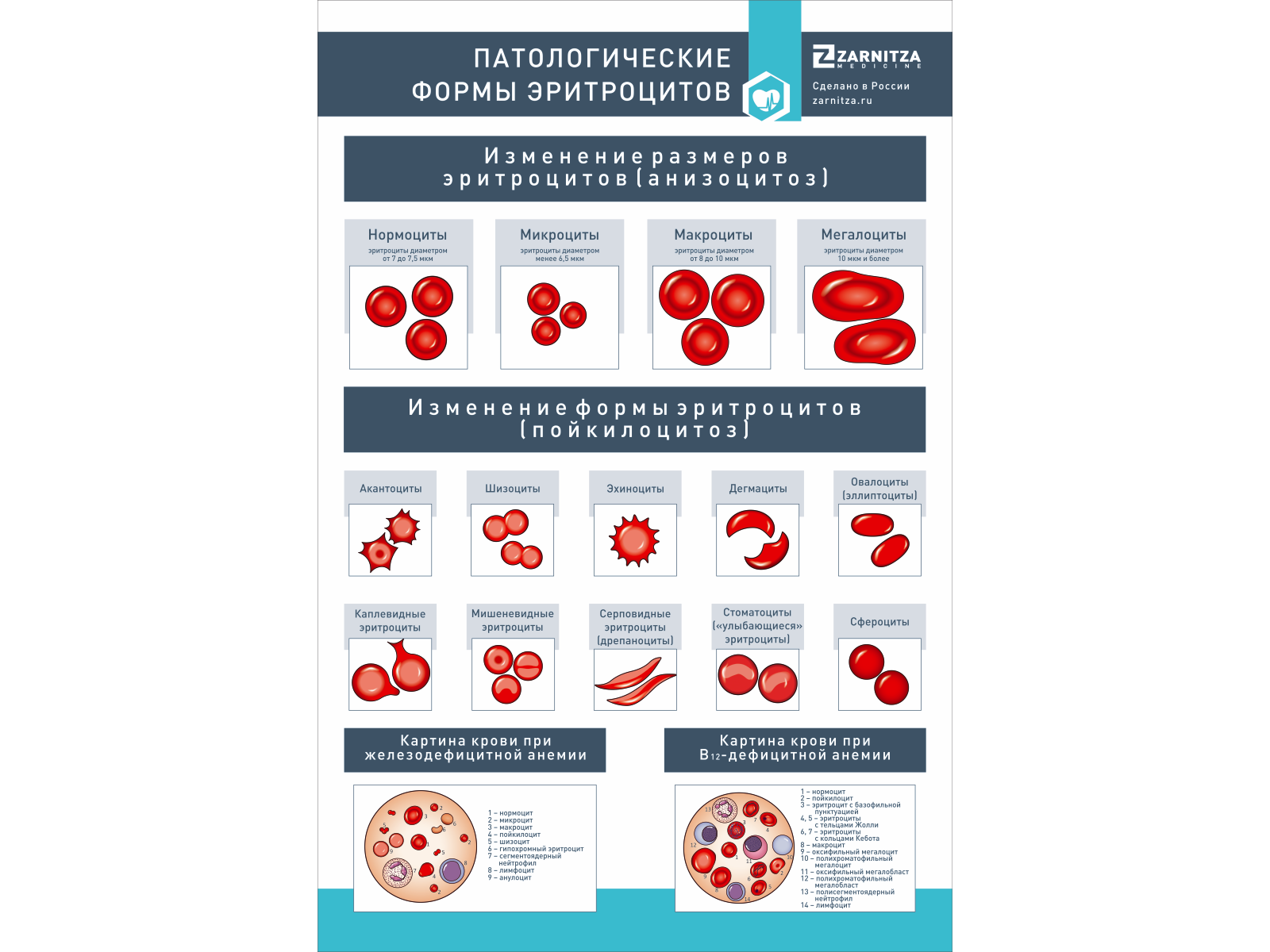 Стенд "Патологические формы эритроцитов" — купить в МЕДСЕТ
