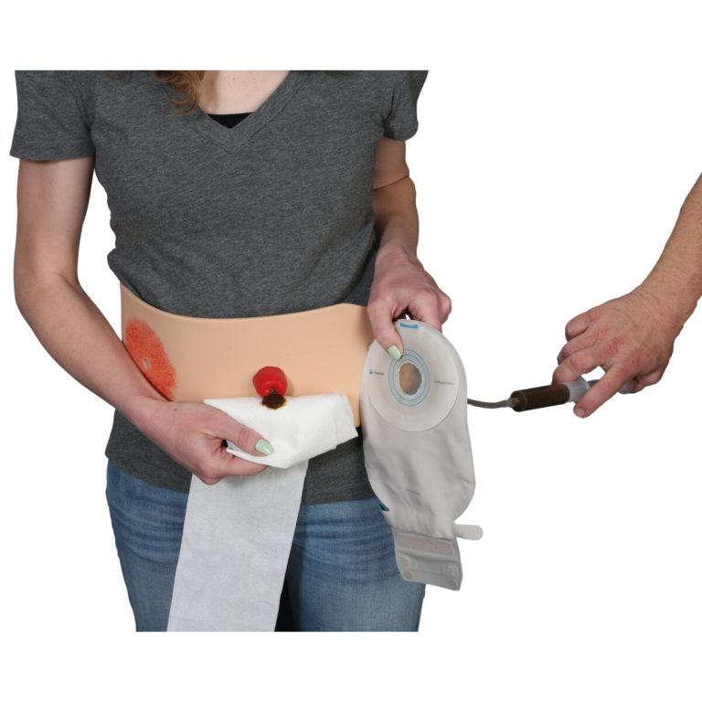 Пояс/тренажер для наложения стомы, светлая кожа — купить в МЕДСЕТ