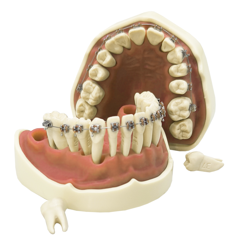 Модель верхней и нижней челюсти для курсов по ортодонтии PD-M ORT — купить в МЕДСЕТ