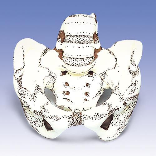 Модель таза, доп. комплектация для W43038 — купить в МЕДСЕТ