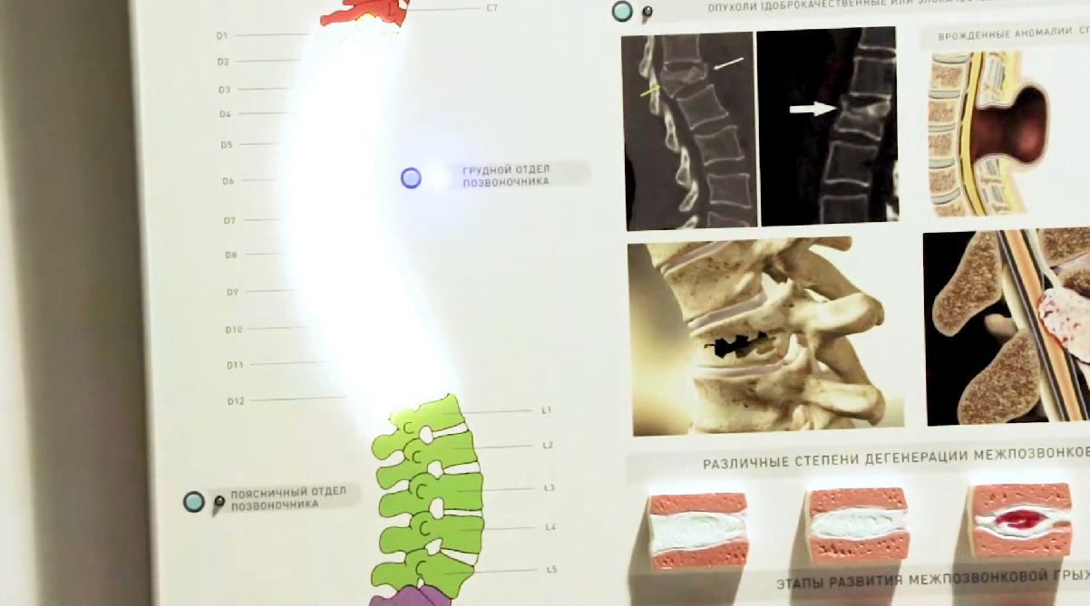 Интерактивный электрифицированный стенд "Патологии позвоночного столба" с натурными образцами — купить в МЕДСЕТ