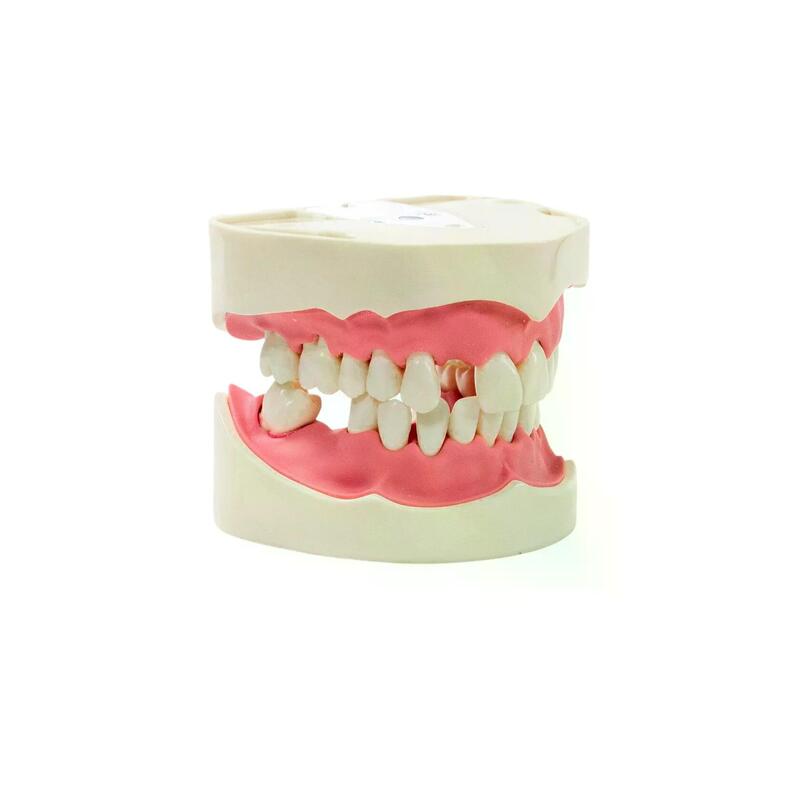 Модель верхней и нижней челюстей c имитацией поздней стадии пародонтита PD-PM — купить в МЕДСЕТ