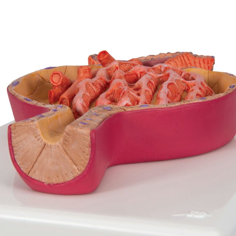 Модель «Мальпигиево тельце почки», 700-кратное увеличение — купить в МЕДСЕТ