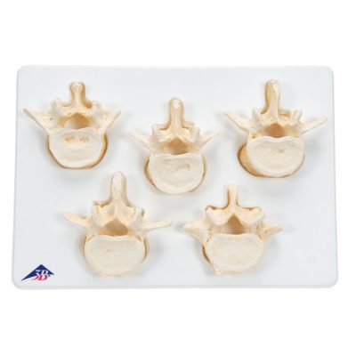 Набор из пяти поясничных позвонков — купить в МЕДСЕТ