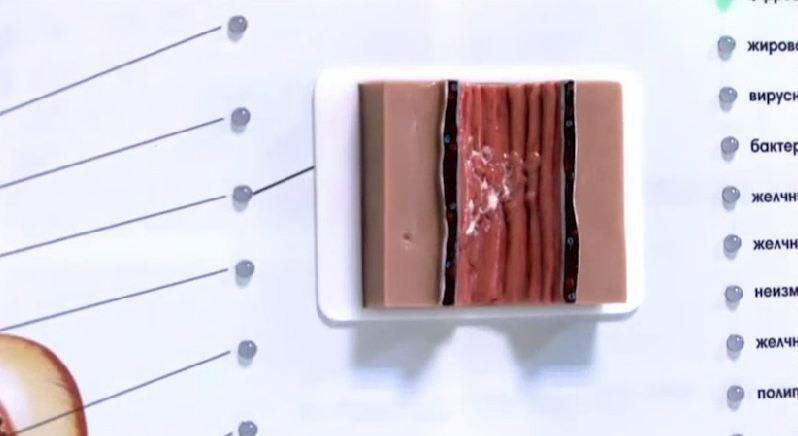 Интерактивный тренажерный комплекс для эндоскопии — купить в МЕДСЕТ