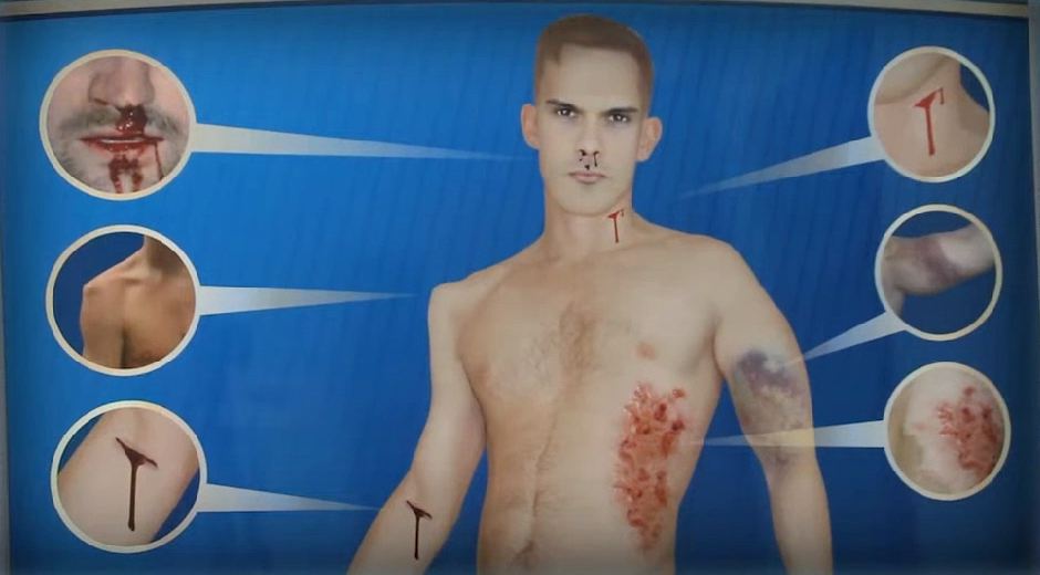 Электрифицированный стенд-тренажер "Травматизм и меры оказания первой помощи" — купить в МЕДСЕТ