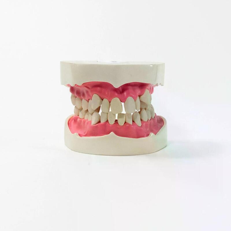 Модель верхней и нижней челюсти для курсов по ортодонтии PD-M ORT — купить в МЕДСЕТ