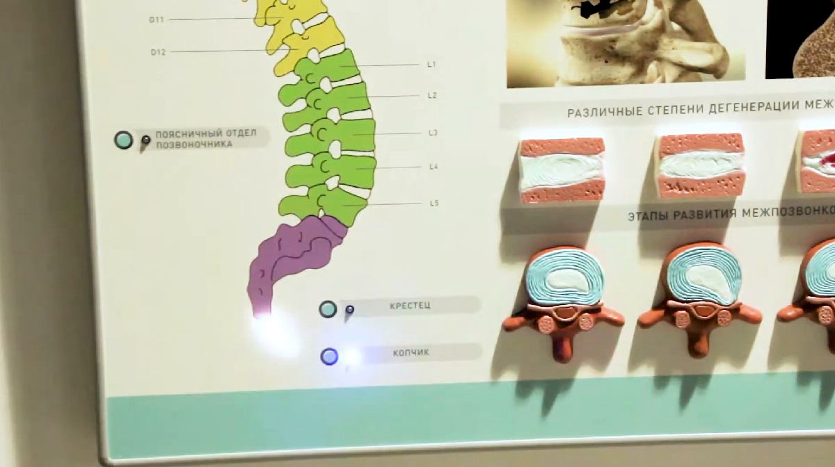 Интерактивный электрифицированный стенд "Патологии позвоночного столба" с натурными образцами — купить в МЕДСЕТ