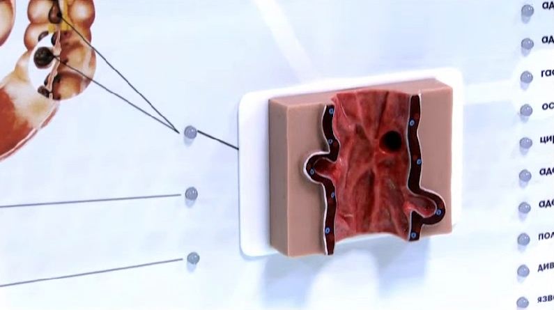 Интерактивный тренажерный комплекс для эндоскопии — купить в МЕДСЕТ