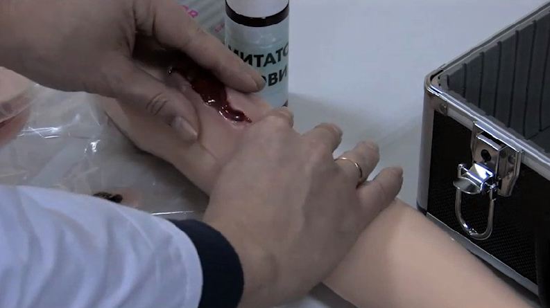 Комплект накладных моделей заболеваний и повреждений кожных покровов человека КР-Н 1.01 — купить в МЕДСЕТ