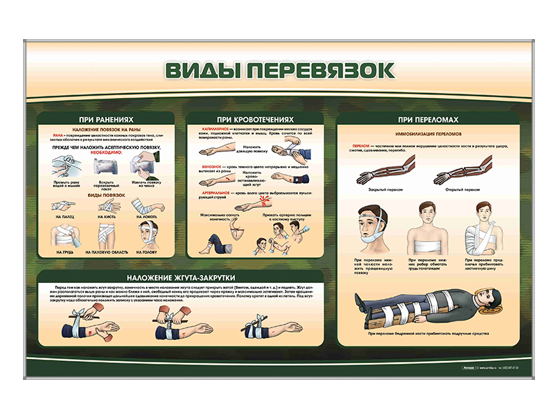 Стенд "Виды перевязок" — купить в МЕДСЕТ