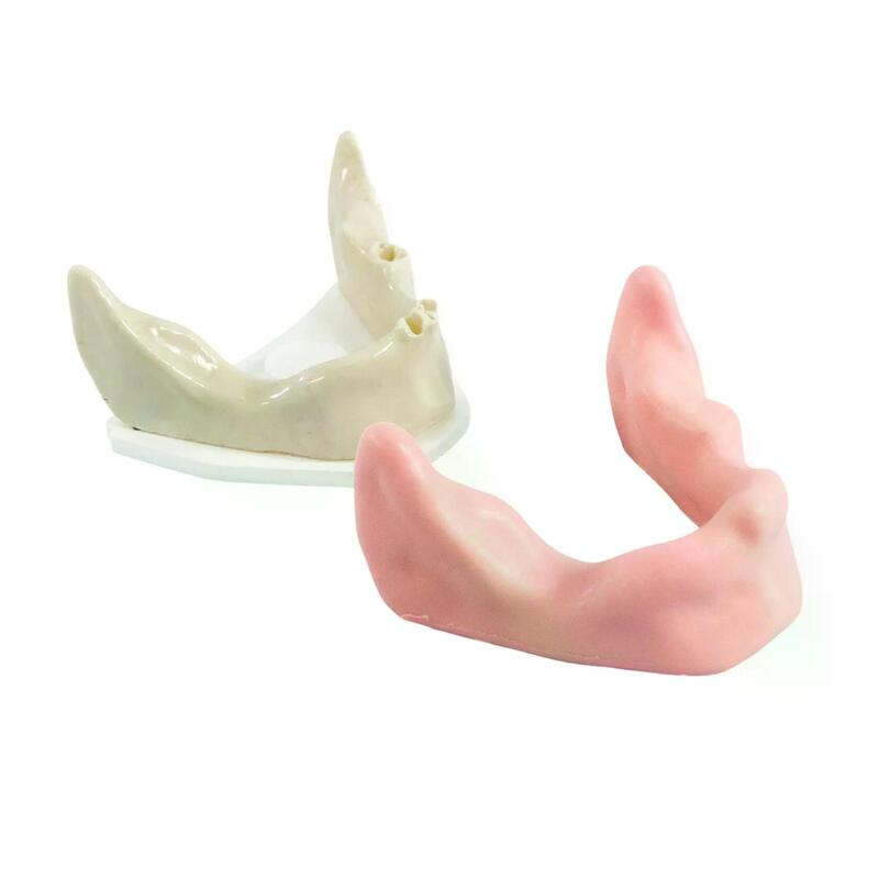 Хирургические модели с переломами — купить в МЕДСЕТ