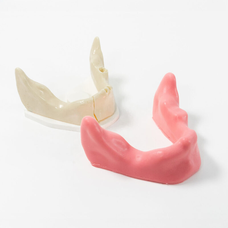 Хирургические модели с переломами — купить в МЕДСЕТ