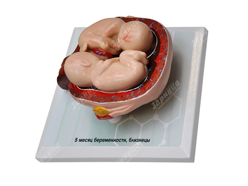 Комплект демонстрационных моделей этапов эмбриогенеза человека — купить в МЕДСЕТ