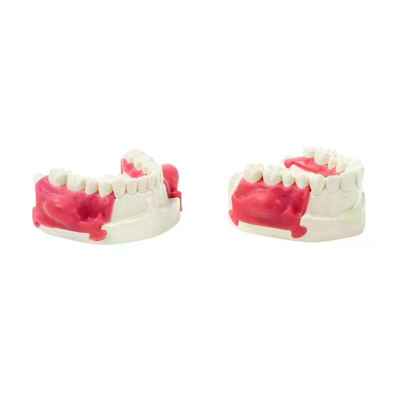 Учебная стоматологическая модель челюсти для отработки инфильтрации, разрезов десны и удаления гноя — купить в МЕДСЕТ