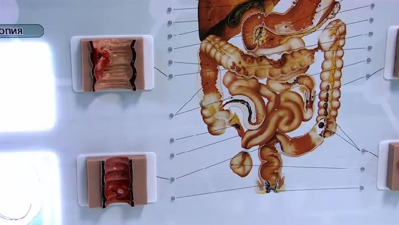 Интерактивный тренажерный комплекс для эндоскопии — купить в МЕДСЕТ