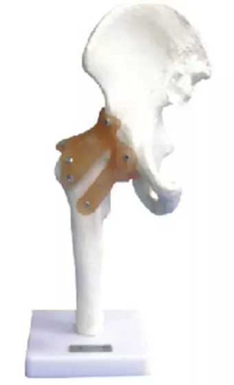 Модель тазобедренного сустава со связками (11209-4) — купить в МЕДСЕТ