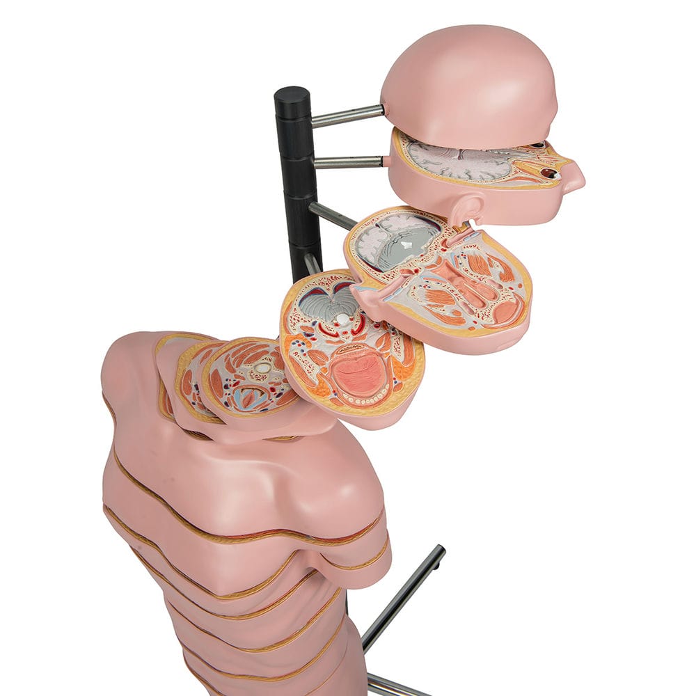 Торс в виде горизонтальных срезов — купить в МЕДСЕТ